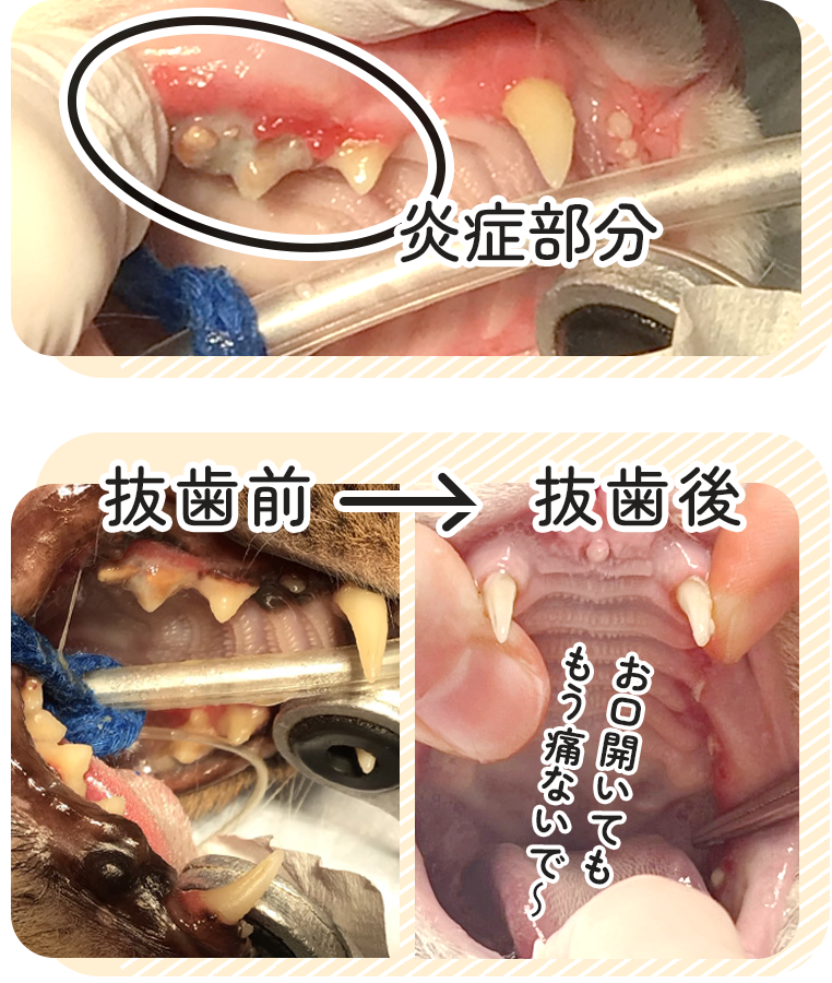 全抜歯ビフォーアフター