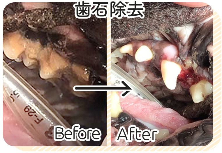 歯石除去ビフォーアフター